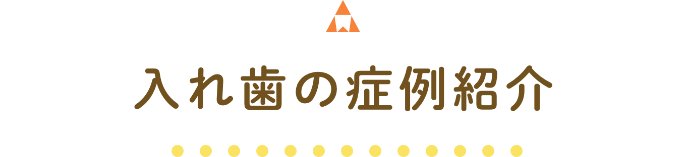 入れ歯の症例紹介